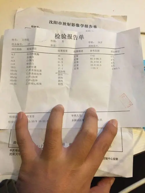 乙肝的症状及表现有哪些