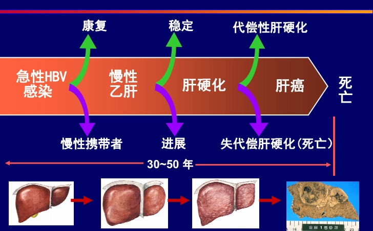 肝炎要怎么治咋改善