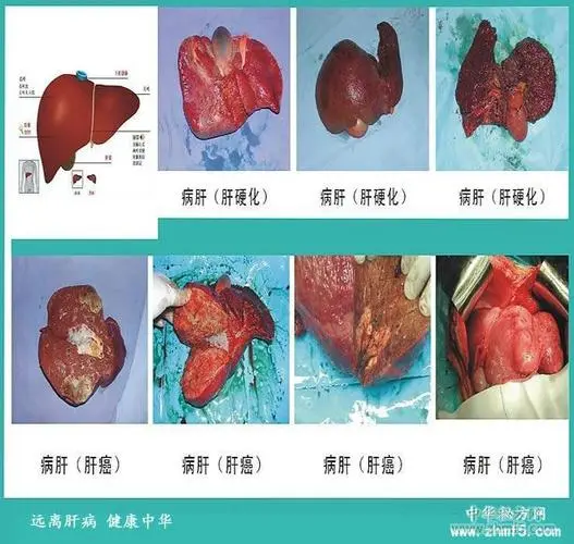 打乙肝疫苗的检查正常吗