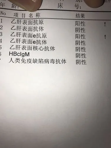 轻度脂肪肝怎么得的