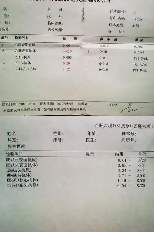 肝硬化是如何分类的