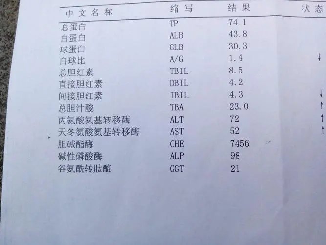 丙肝患者注射疫苗传染吗