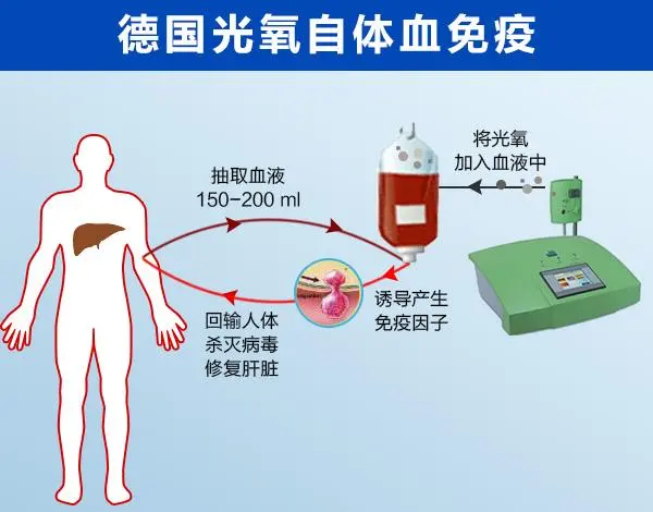 天津哪找治疗肝腹水的医院