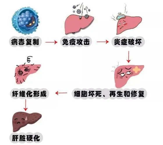 乙肝表面抗原阳性是什么意思正常吗