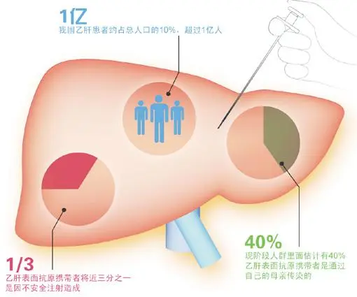 乙肝五项中乙肝表面抗体阳性,其他阴性