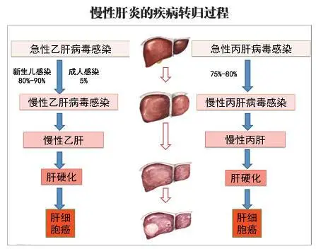 乙肝检查正常么