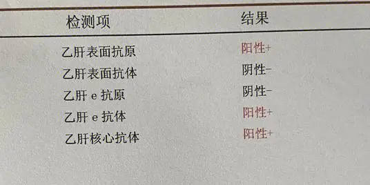 乙肝的症状有什么