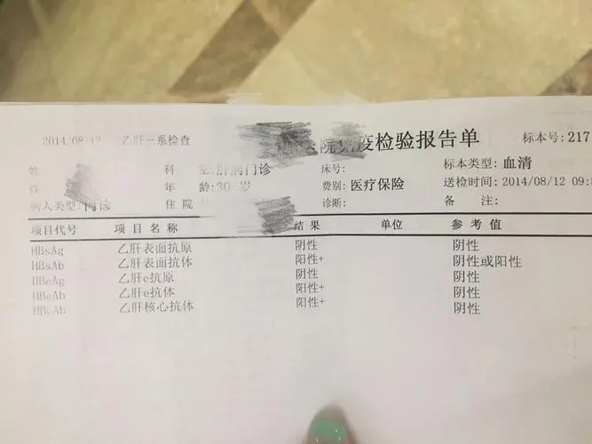 乙肝感染了爱滋病检查两对半有啥表现